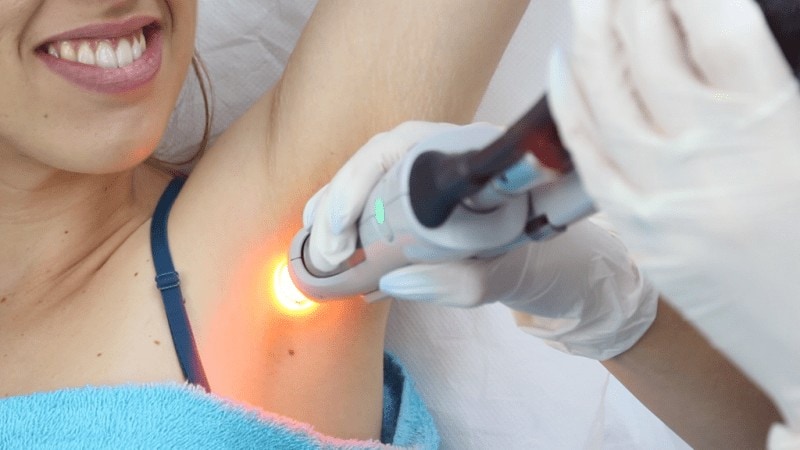 Laser Hair Removal for Travellers